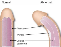 Bentuk Kelamin Pria: Fakta dan Mitos yang Perlu Diketahui