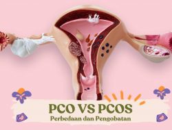 PCO vs PCOS: Memahami Perbedaan yang Penting untuk Kesehatan Reproduksi